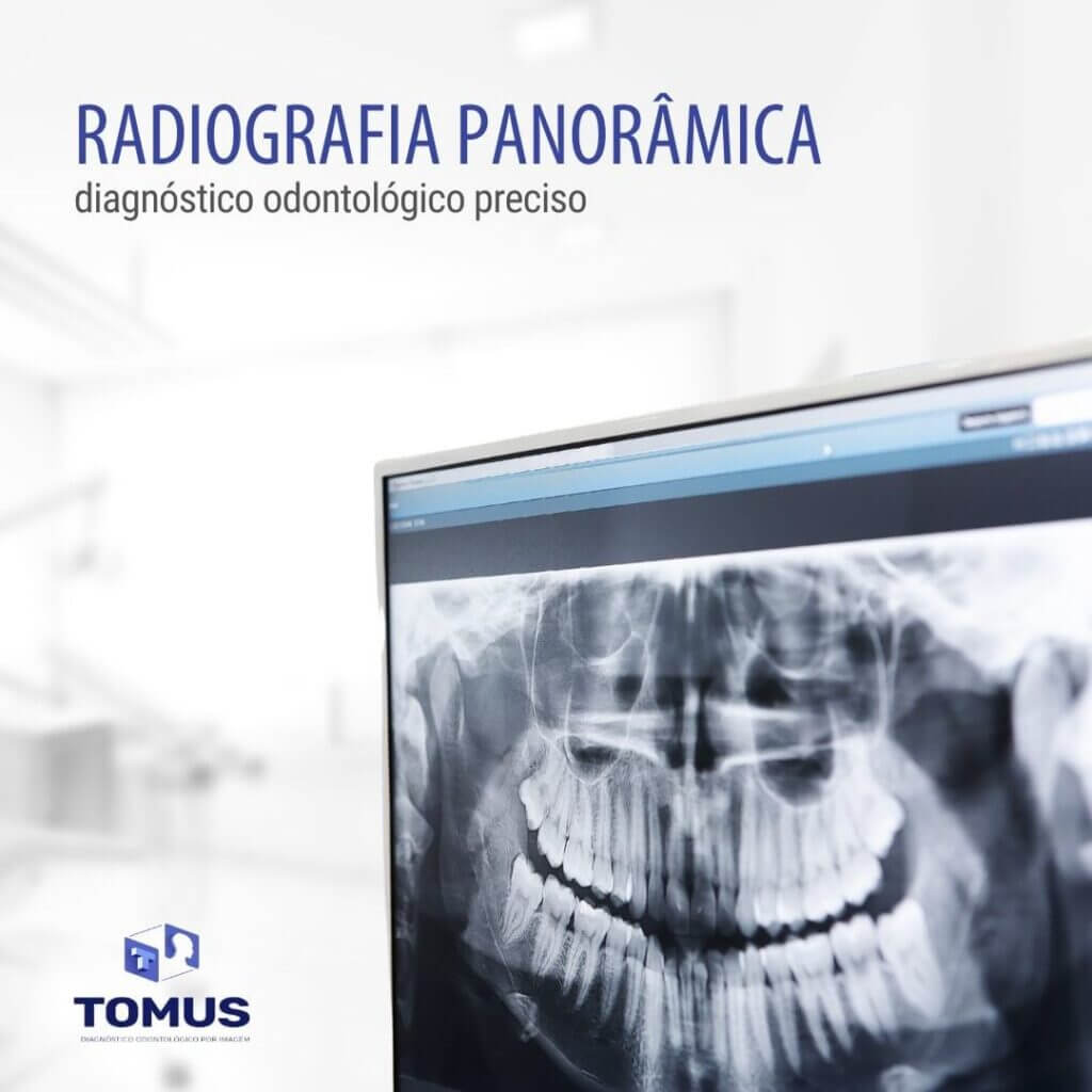 radiografia-panoramica