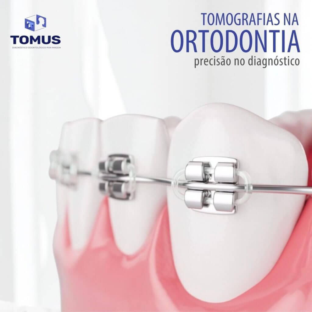 tomografias-na-ortodontia