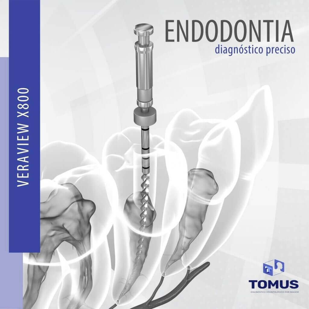 endodontia